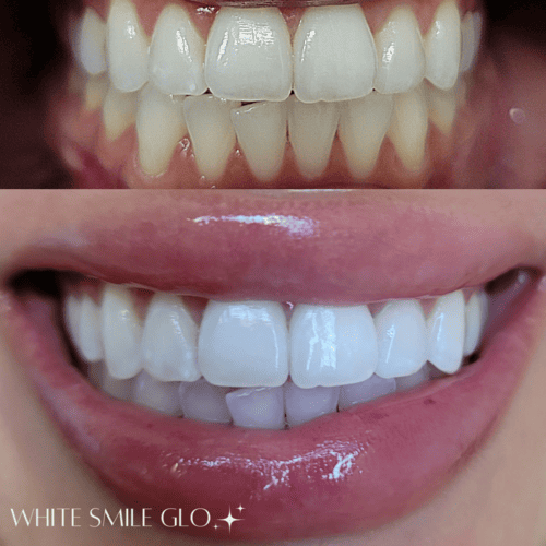 White Smile 7