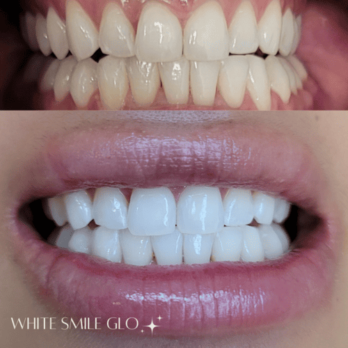 White Smile 8