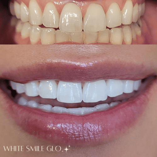 White Smile 9